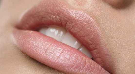tips to clear fordyce spots and white spots on lips